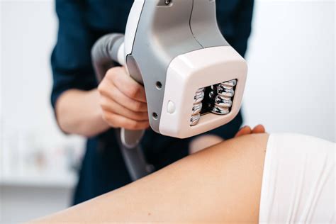 does velashape work.